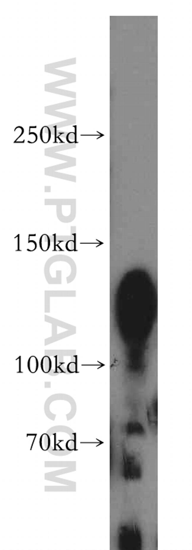 PKP4 Antibody in Western Blot (WB)