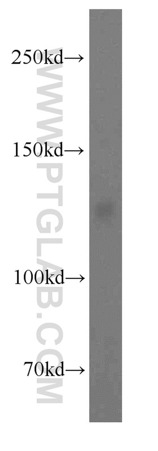 PKP4 Antibody in Western Blot (WB)