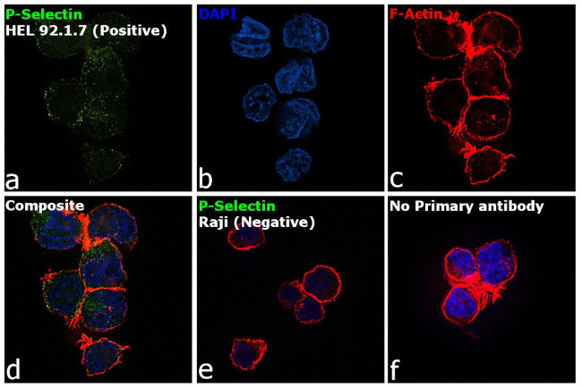 CD62P (P-Selectin) Antibody in Immunocytochemistry (ICC/IF)