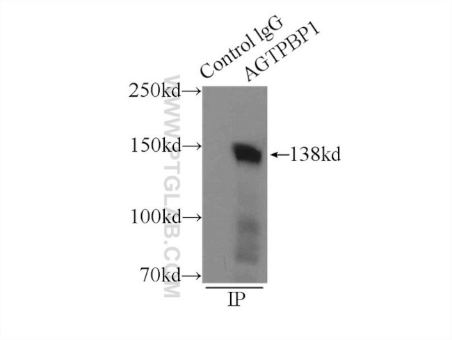 CCP1 Antibody in Immunoprecipitation (IP)