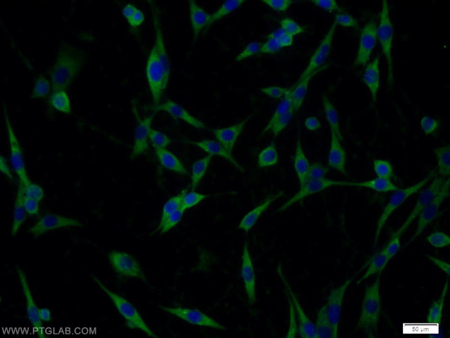 Nicastrin Antibody in Immunocytochemistry (ICC/IF)