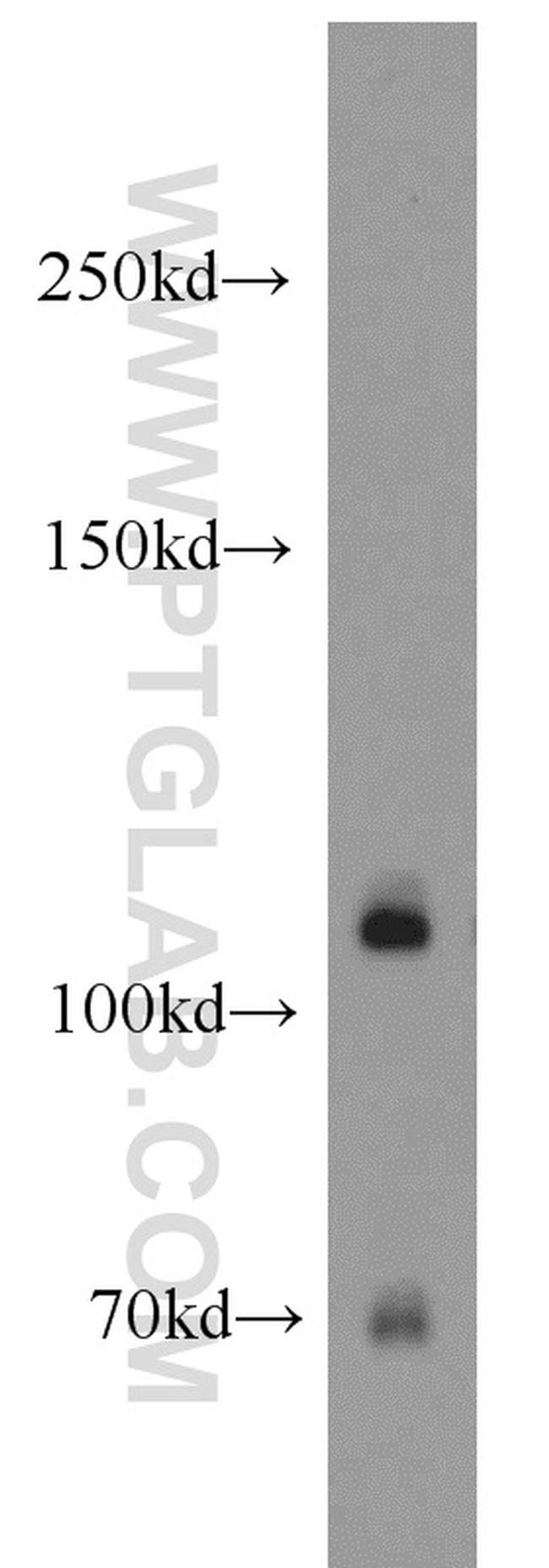 Nicastrin Antibody in Western Blot (WB)