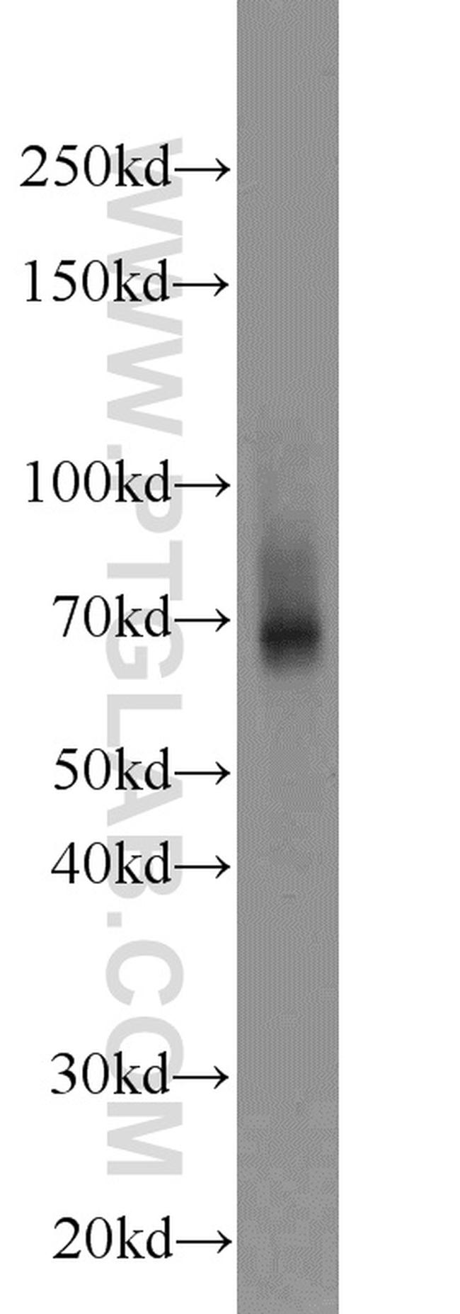 ZNF354A Antibody in Western Blot (WB)