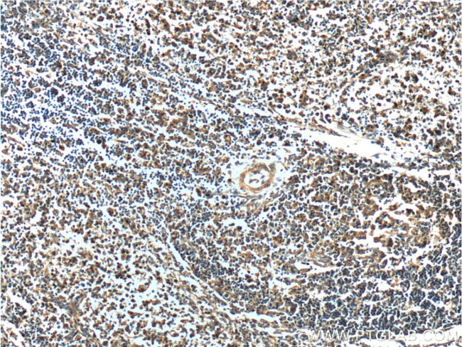 UBE2R2 Antibody in Immunohistochemistry (Paraffin) (IHC (P))