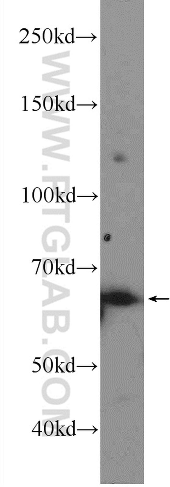 RNF8 Antibody in Western Blot (WB)