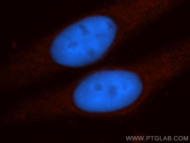 TPPII Antibody in Immunocytochemistry (ICC/IF)