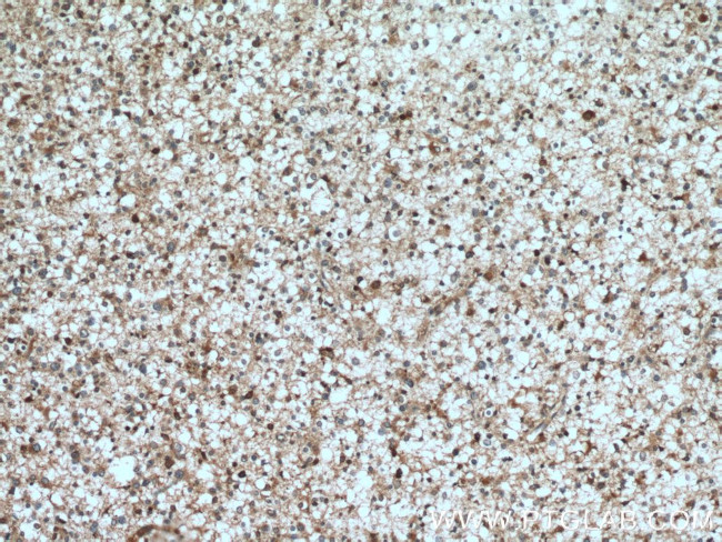 TPPII Antibody in Immunohistochemistry (Paraffin) (IHC (P))