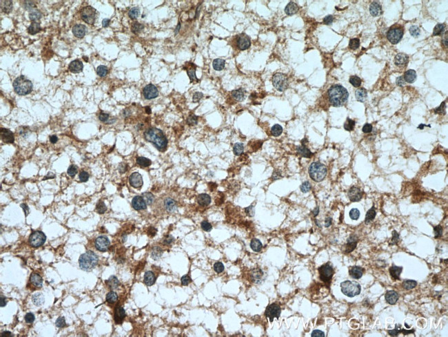 TPPII Antibody in Immunohistochemistry (Paraffin) (IHC (P))