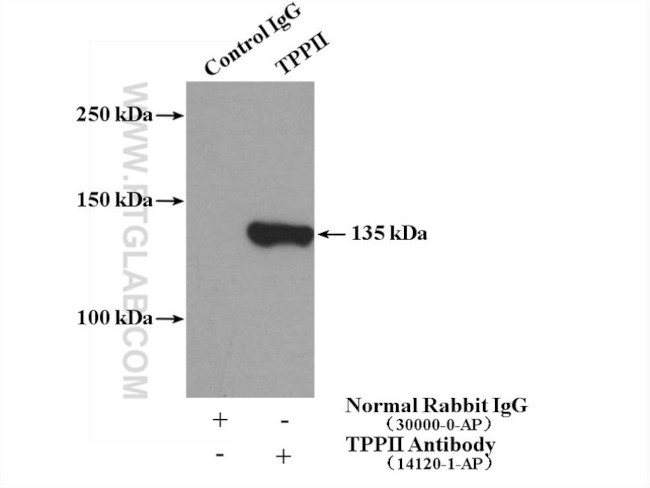 TPPII Antibody in Immunoprecipitation (IP)