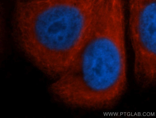 RPS3A Antibody in Immunocytochemistry (ICC/IF)