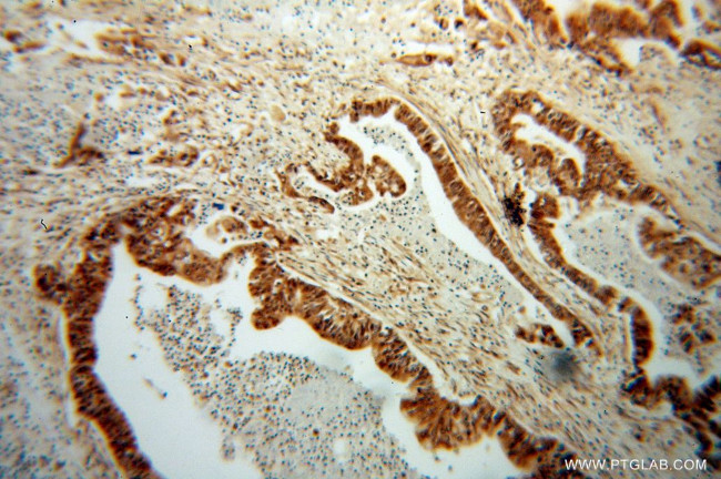 RPS3A Antibody in Immunohistochemistry (Paraffin) (IHC (P))