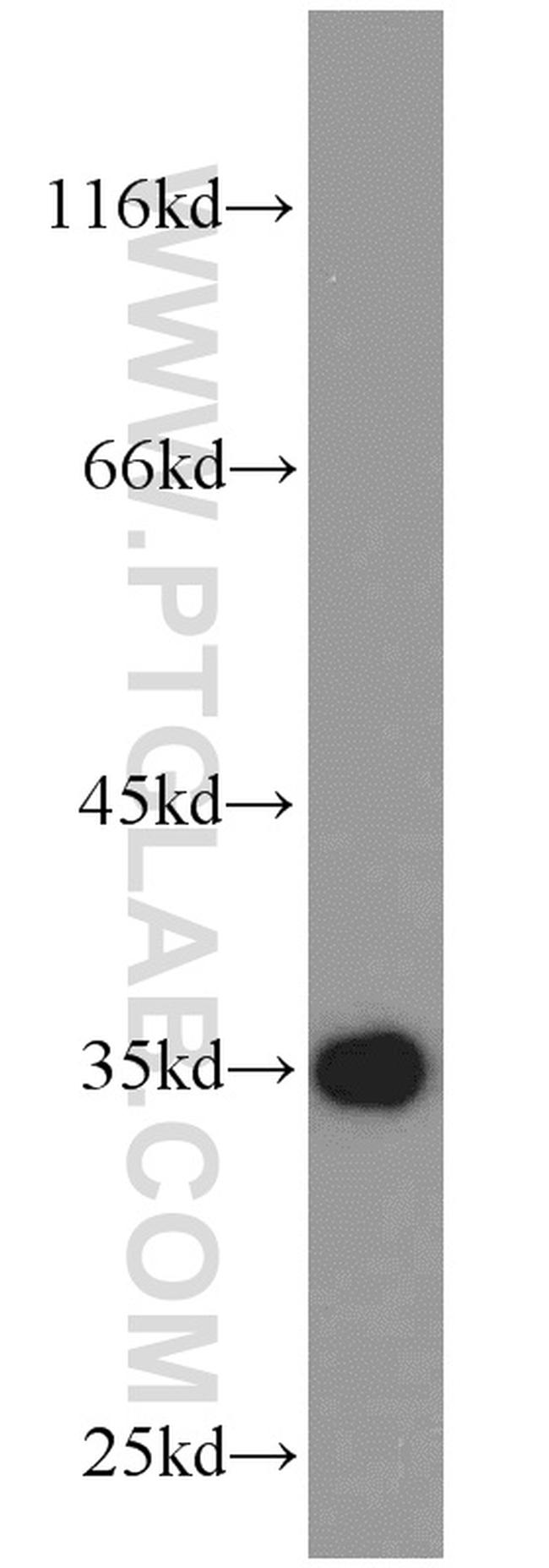 RPS3A Antibody in Western Blot (WB)