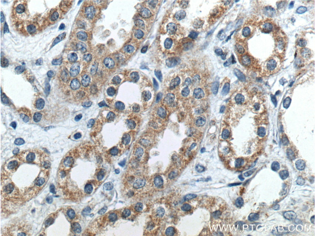 beta-ENaC Antibody in Immunohistochemistry (Paraffin) (IHC (P))