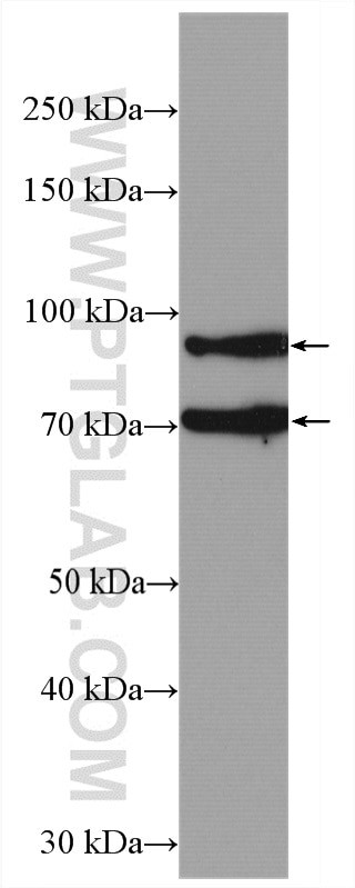 ADAM12 Antibody in Western Blot (WB)