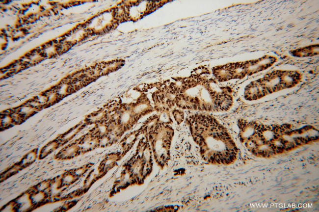 FKBP5 Antibody in Immunohistochemistry (Paraffin) (IHC (P))