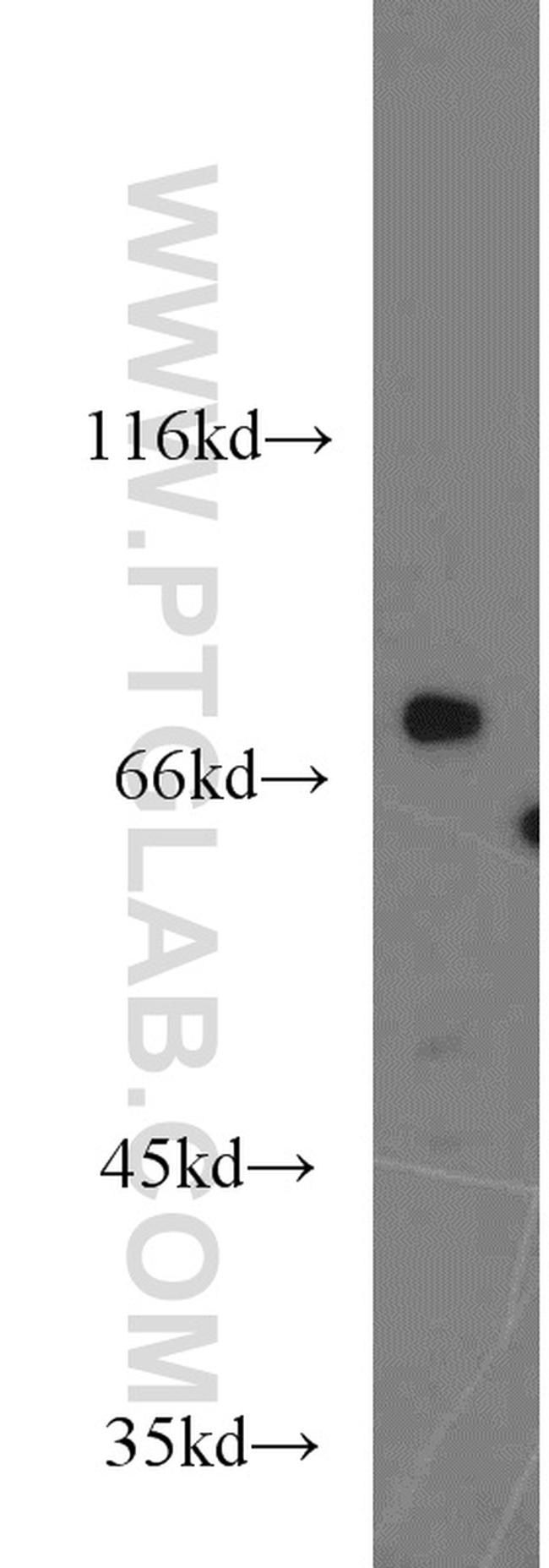 TNK1 Antibody in Western Blot (WB)