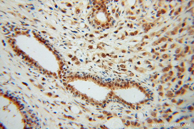 CSTF2T Antibody in Immunohistochemistry (Paraffin) (IHC (P))