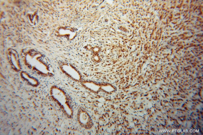 CSTF2T Antibody in Immunohistochemistry (Paraffin) (IHC (P))