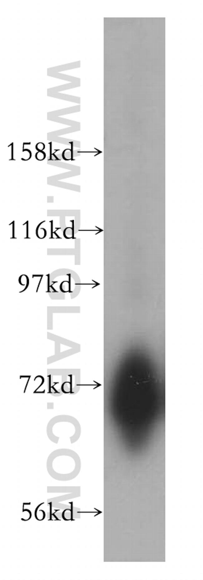 CSTF2T Antibody in Western Blot (WB)