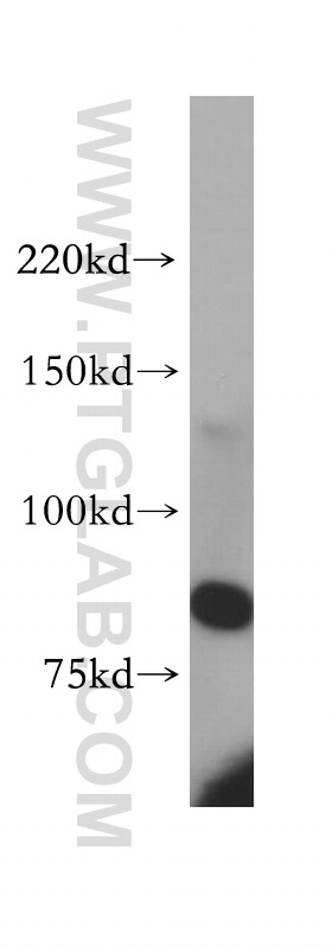 PLCD1 Antibody in Western Blot (WB)