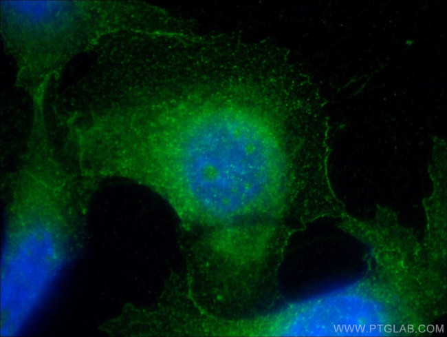 MPI Antibody in Immunocytochemistry (ICC/IF)