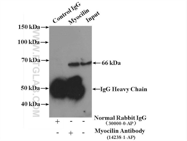 Myocilin Antibody in Immunoprecipitation (IP)