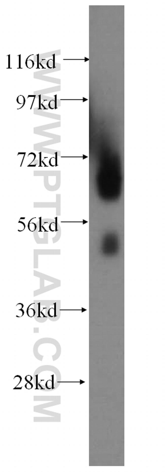Myocilin Antibody in Western Blot (WB)