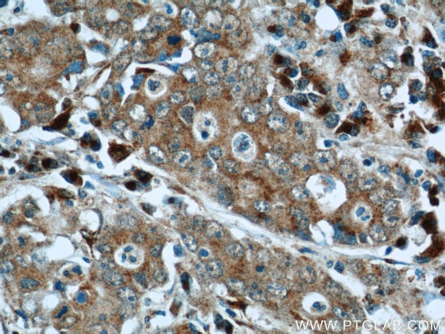 FAM3C Antibody in Immunohistochemistry (Paraffin) (IHC (P))