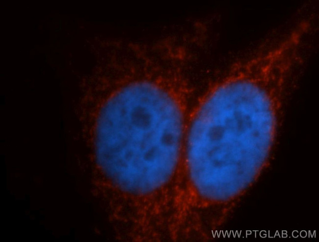 ITPKA Antibody in Immunocytochemistry (ICC/IF)