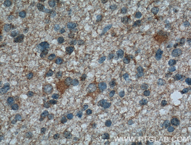 ITPKA Antibody in Immunohistochemistry (Paraffin) (IHC (P))