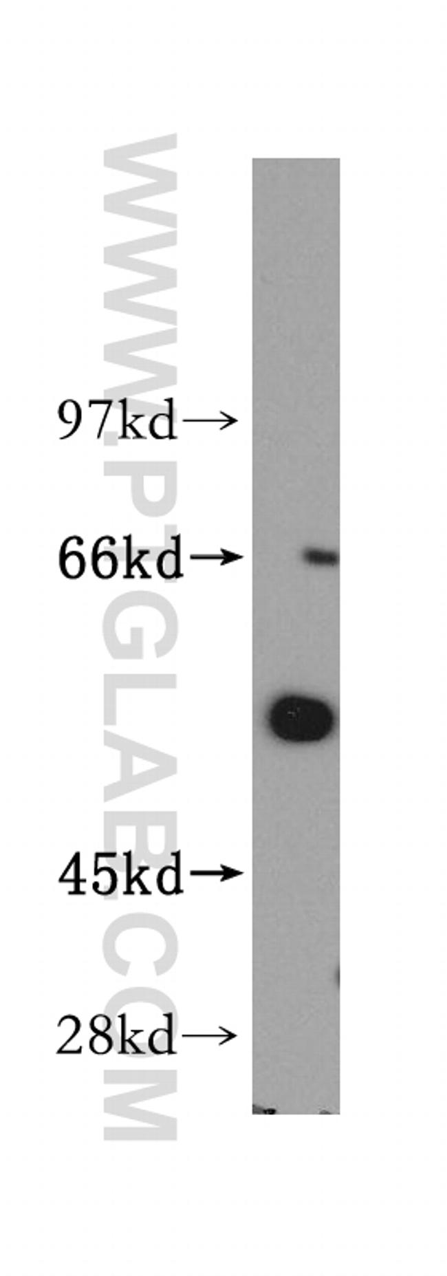 ITPKA Antibody in Western Blot (WB)