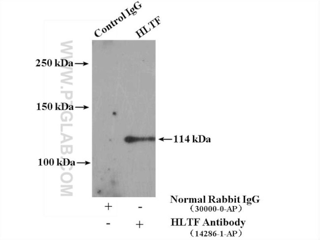 HLTF Antibody in Immunoprecipitation (IP)