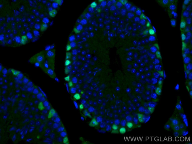 DMRT1 Antibody in Immunohistochemistry (Paraffin) (IHC (P))