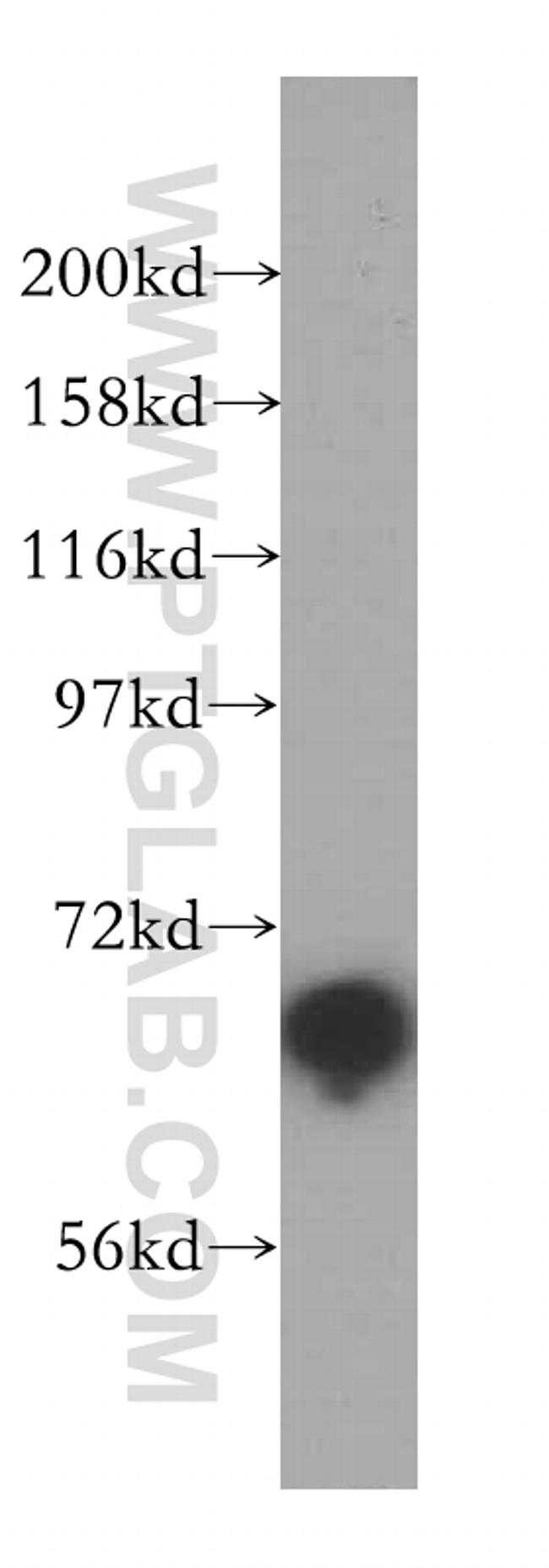 NUB1 Antibody in Western Blot (WB)