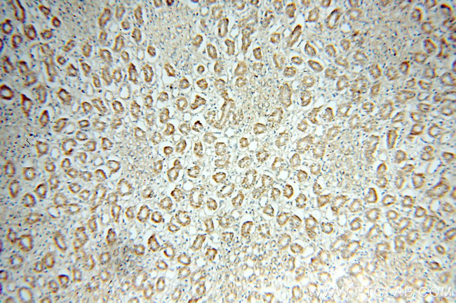 NOX4 Antibody in Immunohistochemistry (Paraffin) (IHC (P))