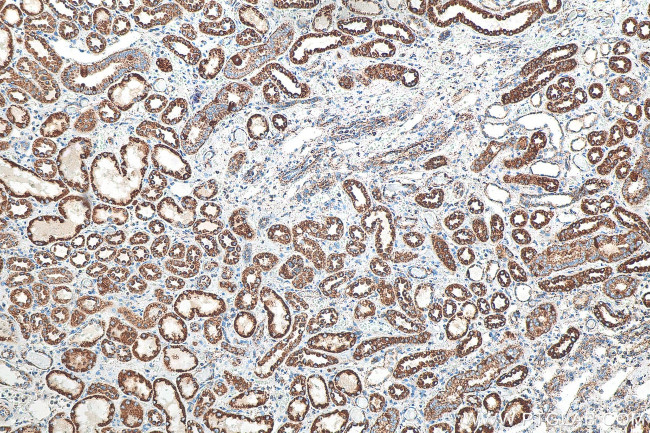 NOX4 Antibody in Immunohistochemistry (Paraffin) (IHC (P))