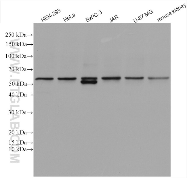 NOX4 Antibody in Western Blot (WB)