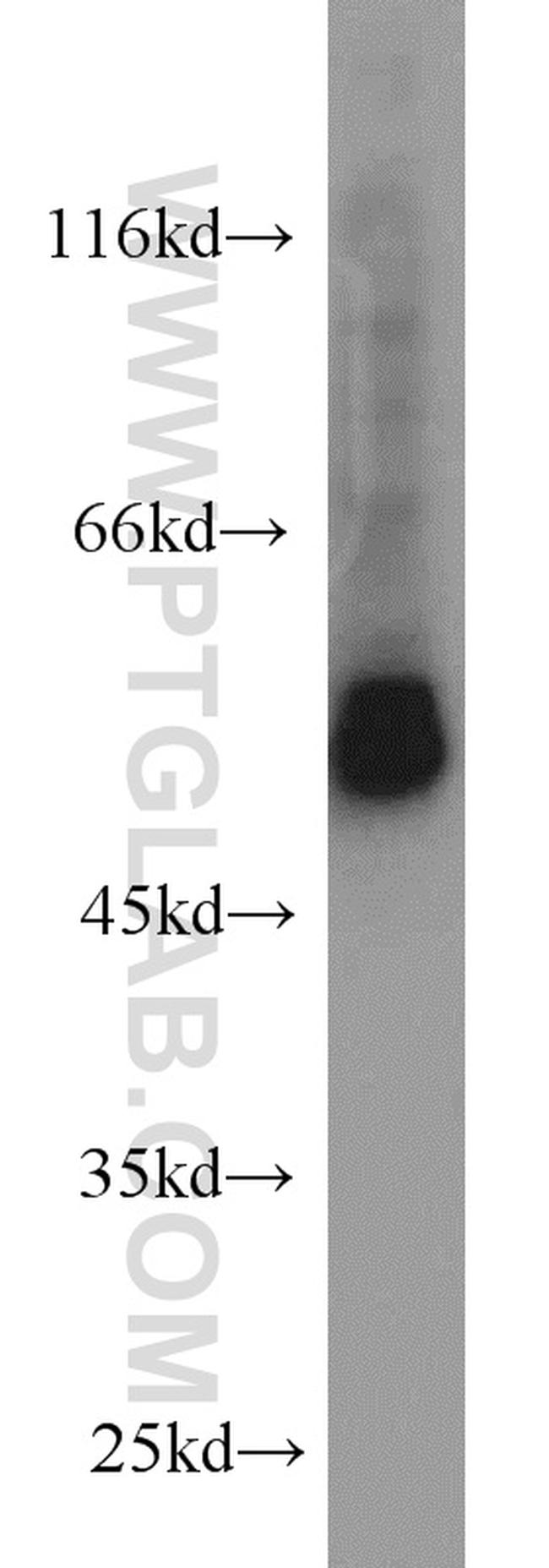 NOX4 Antibody in Western Blot (WB)