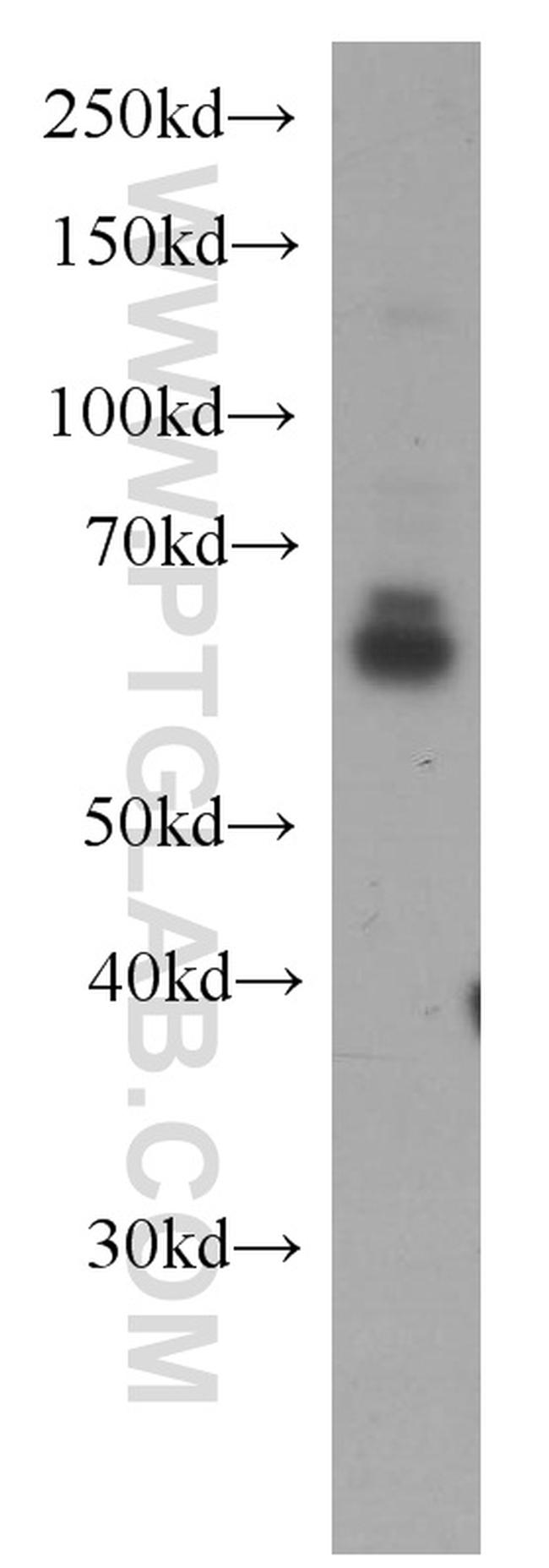 NOX4 Antibody in Western Blot (WB)