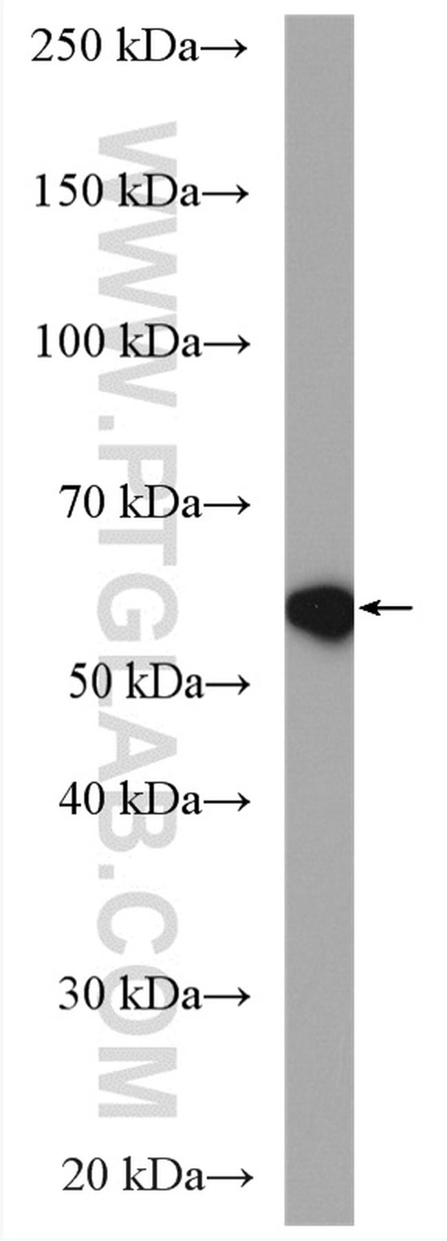 NOX4 Antibody in Western Blot (WB)