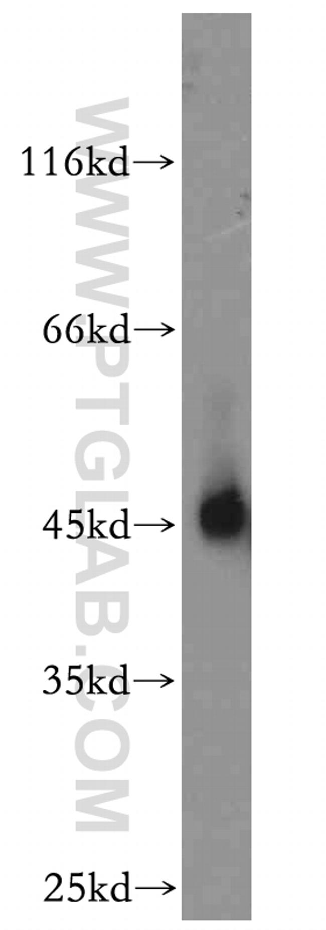 NR1H3 Antibody in Western Blot (WB)