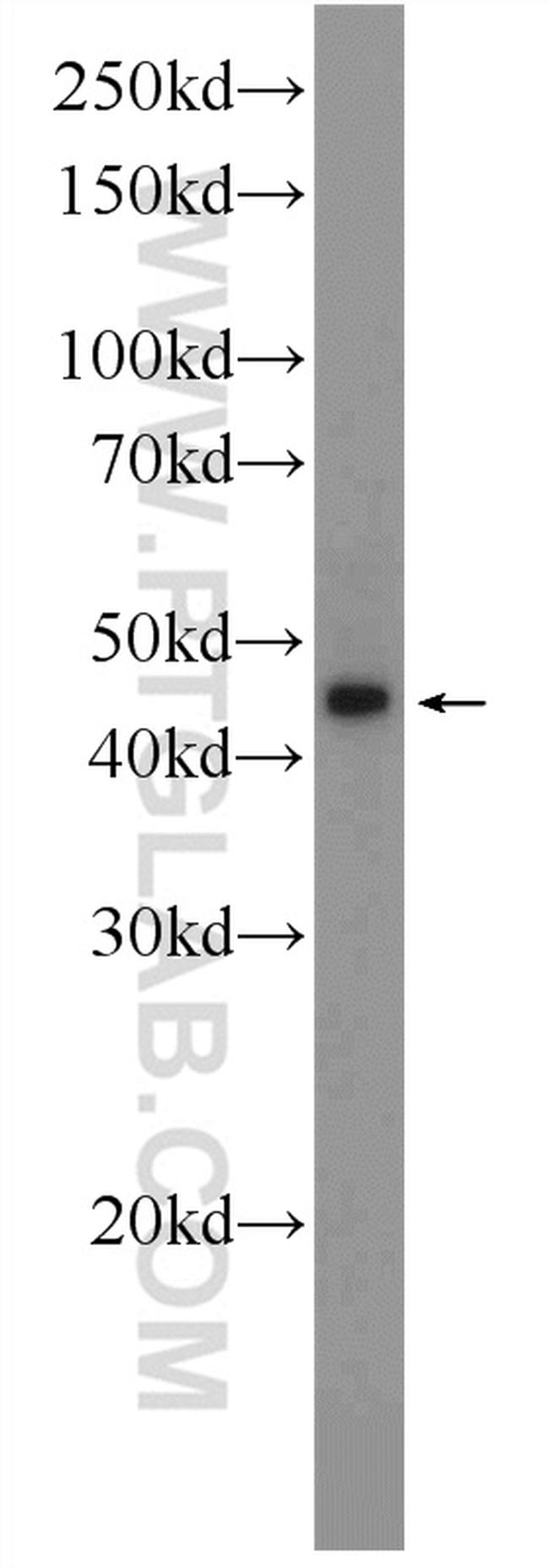 NR1H3 Antibody in Western Blot (WB)