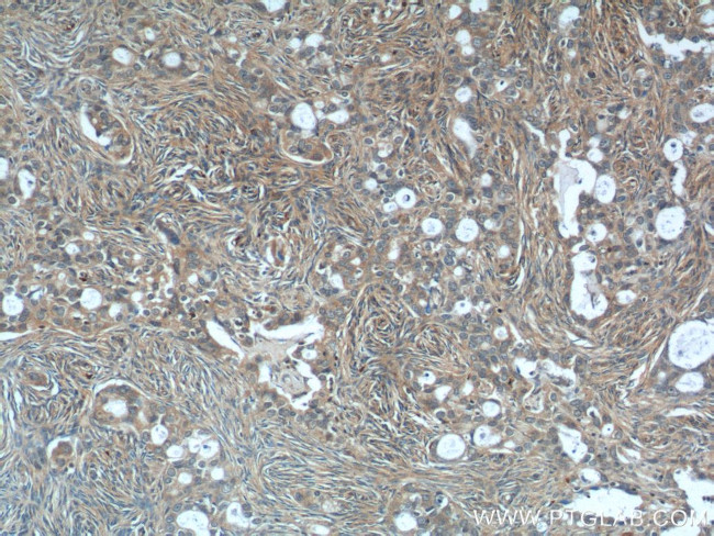 USP15 Antibody in Immunohistochemistry (Paraffin) (IHC (P))