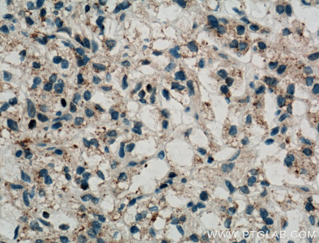 USP15 Antibody in Immunohistochemistry (Paraffin) (IHC (P))