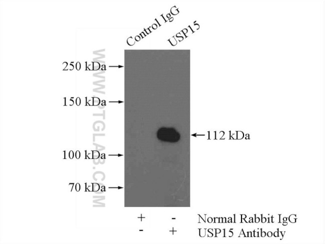 USP15 Antibody in Immunoprecipitation (IP)