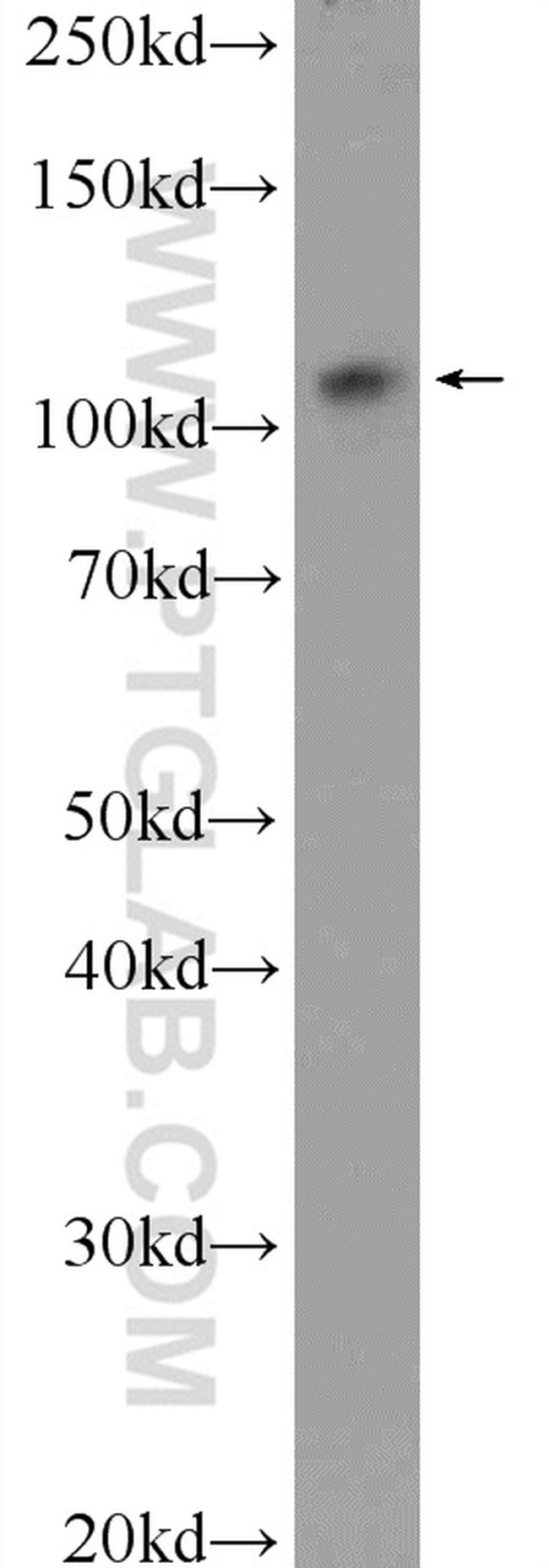 USP15 Antibody in Western Blot (WB)