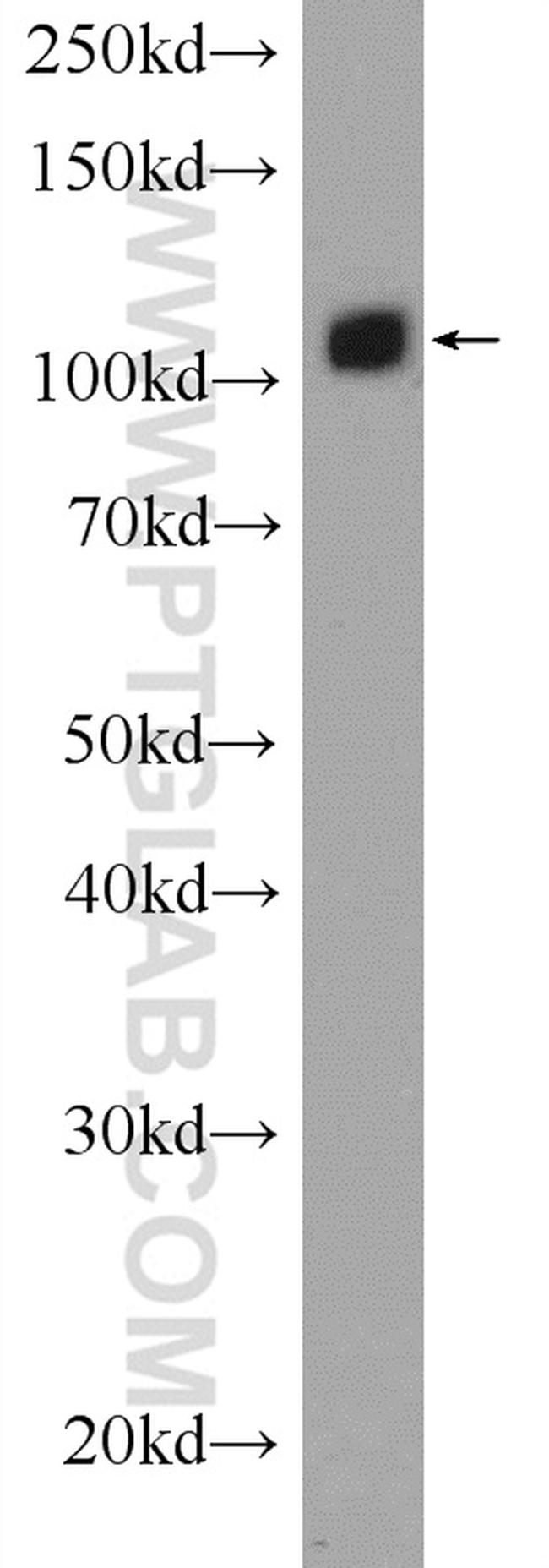 USP15 Antibody in Western Blot (WB)