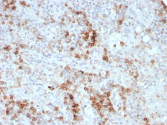 GM-CSF (Granulocyte/Macrophage - Colony Stimulating Factor) Antibody in Immunohistochemistry (Paraffin) (IHC (P))