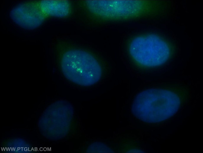 PSMA2 Antibody in Immunocytochemistry (ICC/IF)