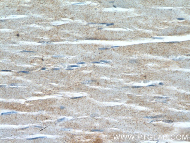 PSMA2 Antibody in Immunohistochemistry (Paraffin) (IHC (P))